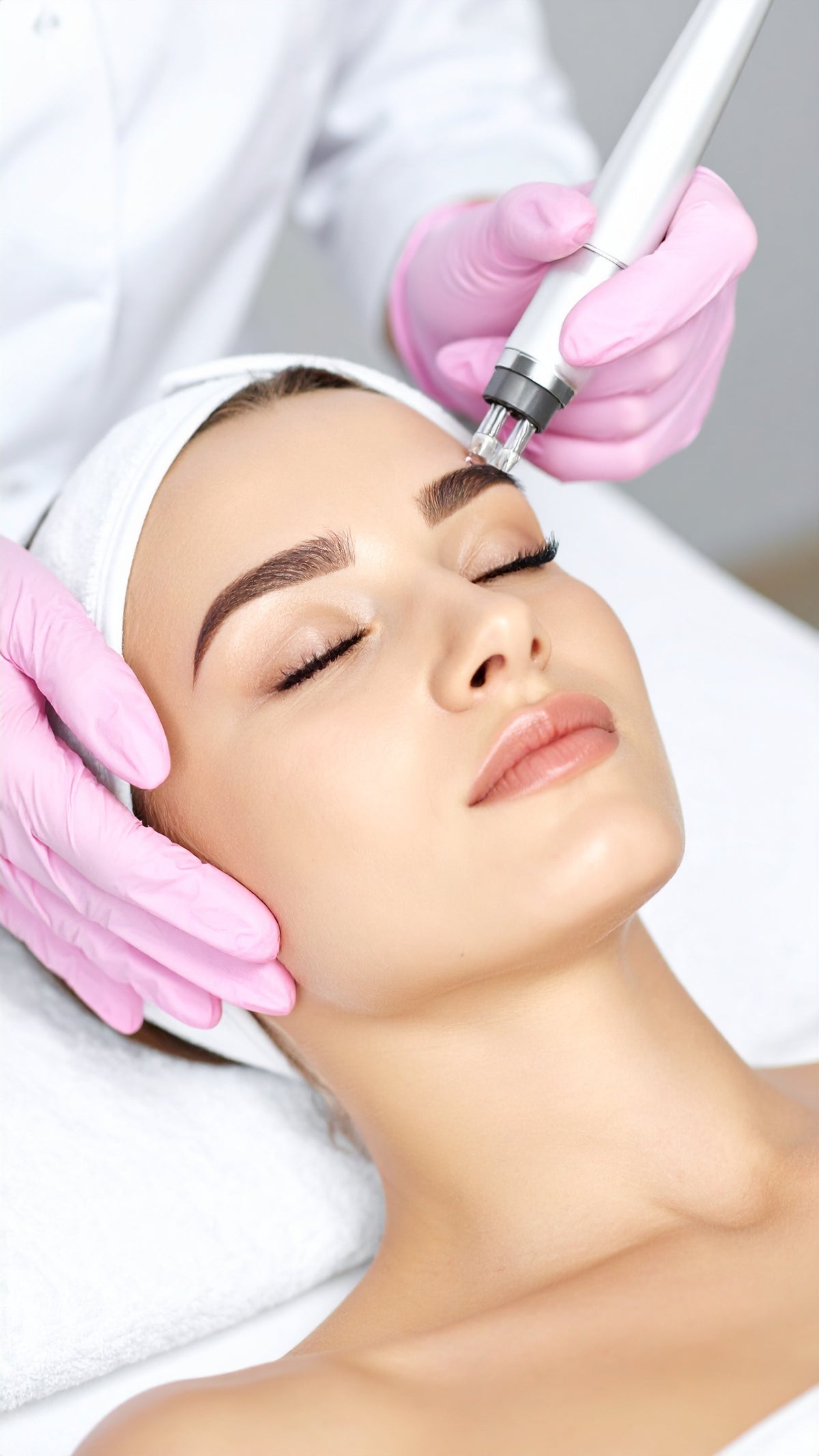 60 Minuten Microneedling