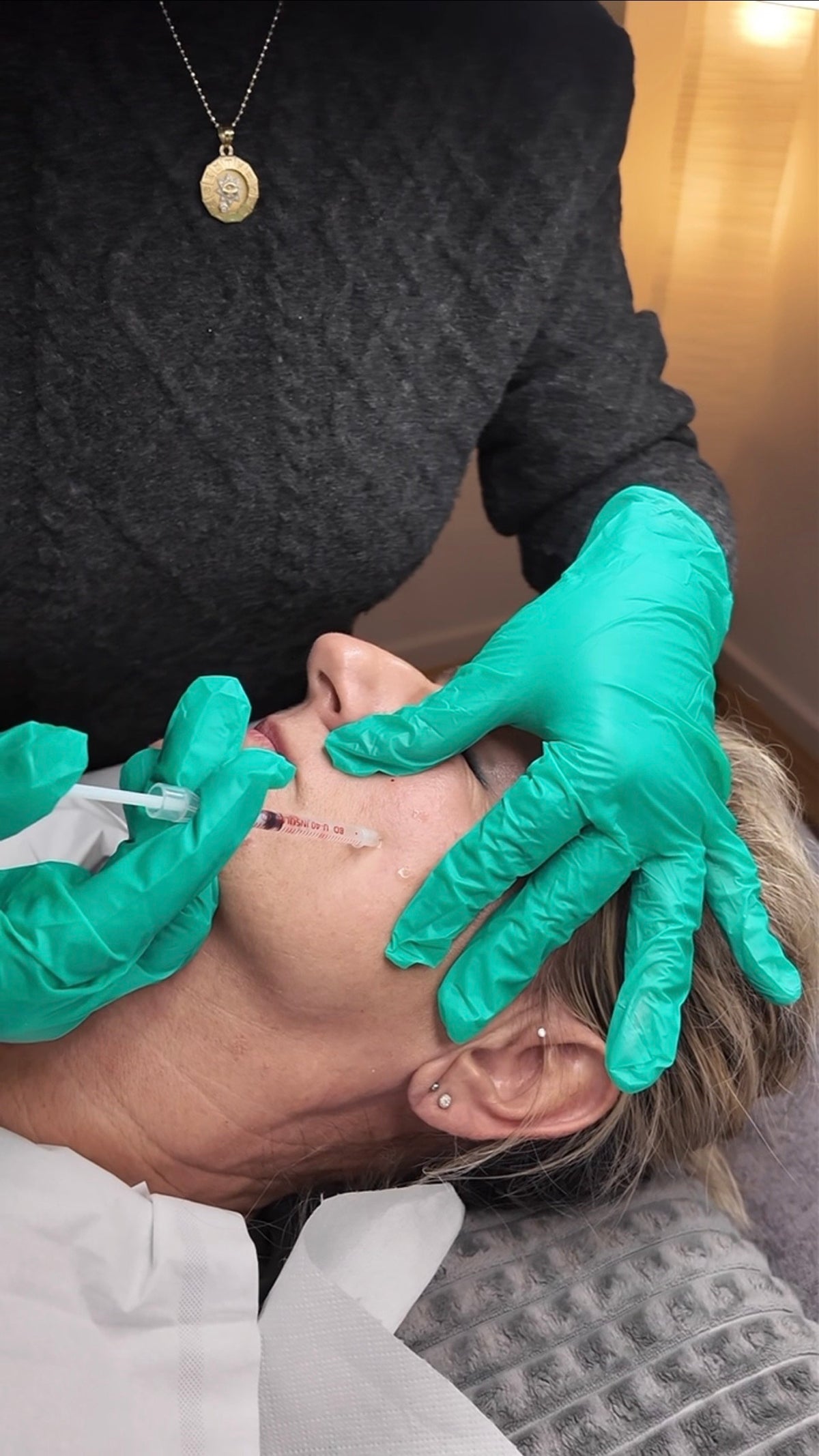 Mesotherapie mit Hyaluron