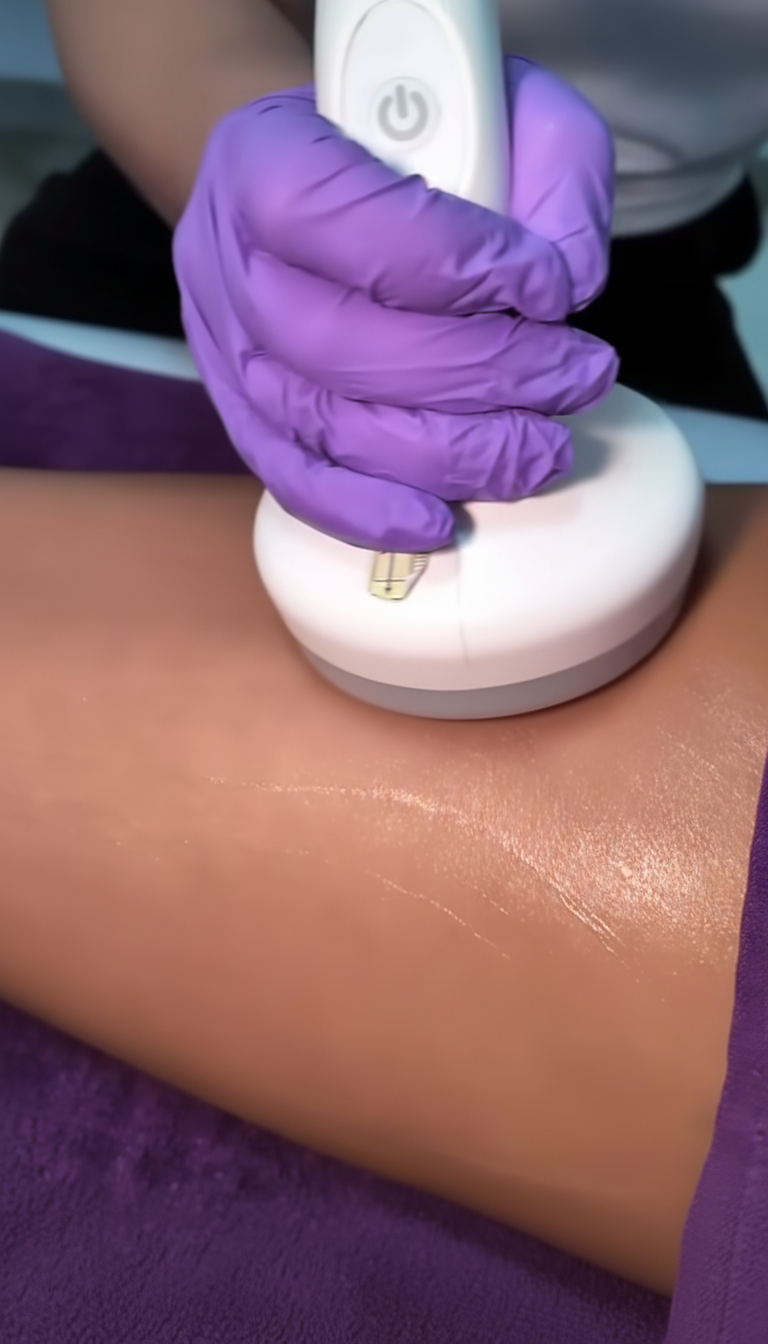 T-Shaping Behandlung