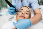 Frau erhält eine Microneedling-Behandlung mit einem elektrischen Dermapen, durchgeführt von einer Fachkraft mit blauen Handschuhen im Kosmetikinstitut
