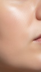 Microdermabrasion