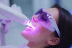 Frau erhält kosmetisches Zahnbleaching mit LED-Licht und Schutzbrille