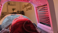 Microneedling