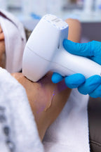 Nahaufnahme einer dauerhaften Laser-Haarentfernung am Unterarm, durchgeführt mit einem modernen Gerät von einer Fachkraft mit blauen Handschuhen