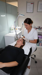 Microneedling