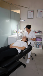 Microneedling