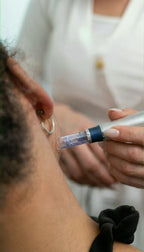 Medizinisches Microneedling