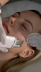Gesichtsreinigung mit Fruchtsäurepeeling