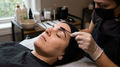 Browlifting