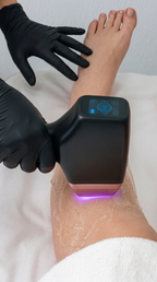 Diodenlaser Haarentfernung an den Beinen bei Samar Cosmetic Bochum – professionelle Laserbehandlung zur dauerhaften Haarreduktion