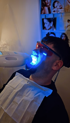 Zahnbleaching bei Beve Beauty Hanau – kosmetische Zahnaufhellung mit LED Licht zur Unterstützung eines sichtbar helleren Lächelns