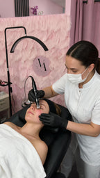 Kosmetisches Microneedling