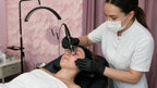 Kosmetisches Microneedling