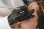 Nahaufnahme einer ästhetischen Plasma-Pen Behandlung an der Stirn durch eine Fachkraft mit schwarzen Handschuhen
