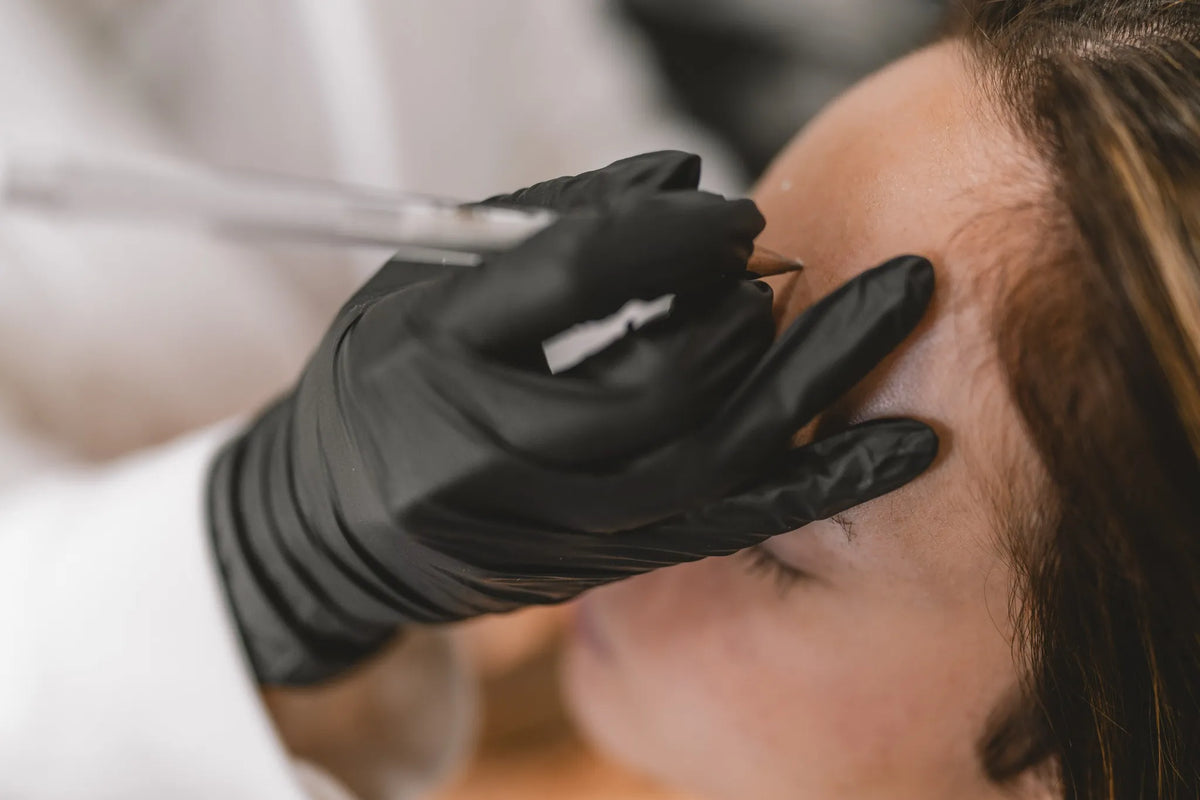 Nahaufnahme einer ästhetischen Plasma-Pen Behandlung an der Stirn durch eine Fachkraft mit schwarzen Handschuhen