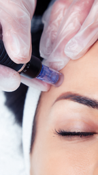 Aquafacial & Microneedling